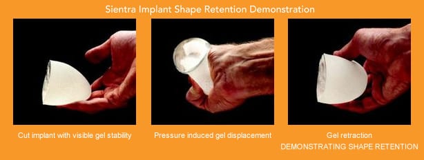 sientra-implants-shape-retention