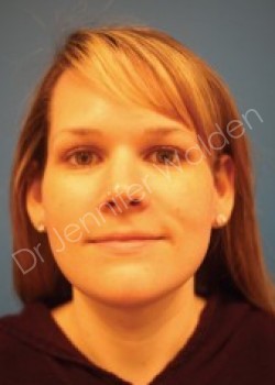 After Image